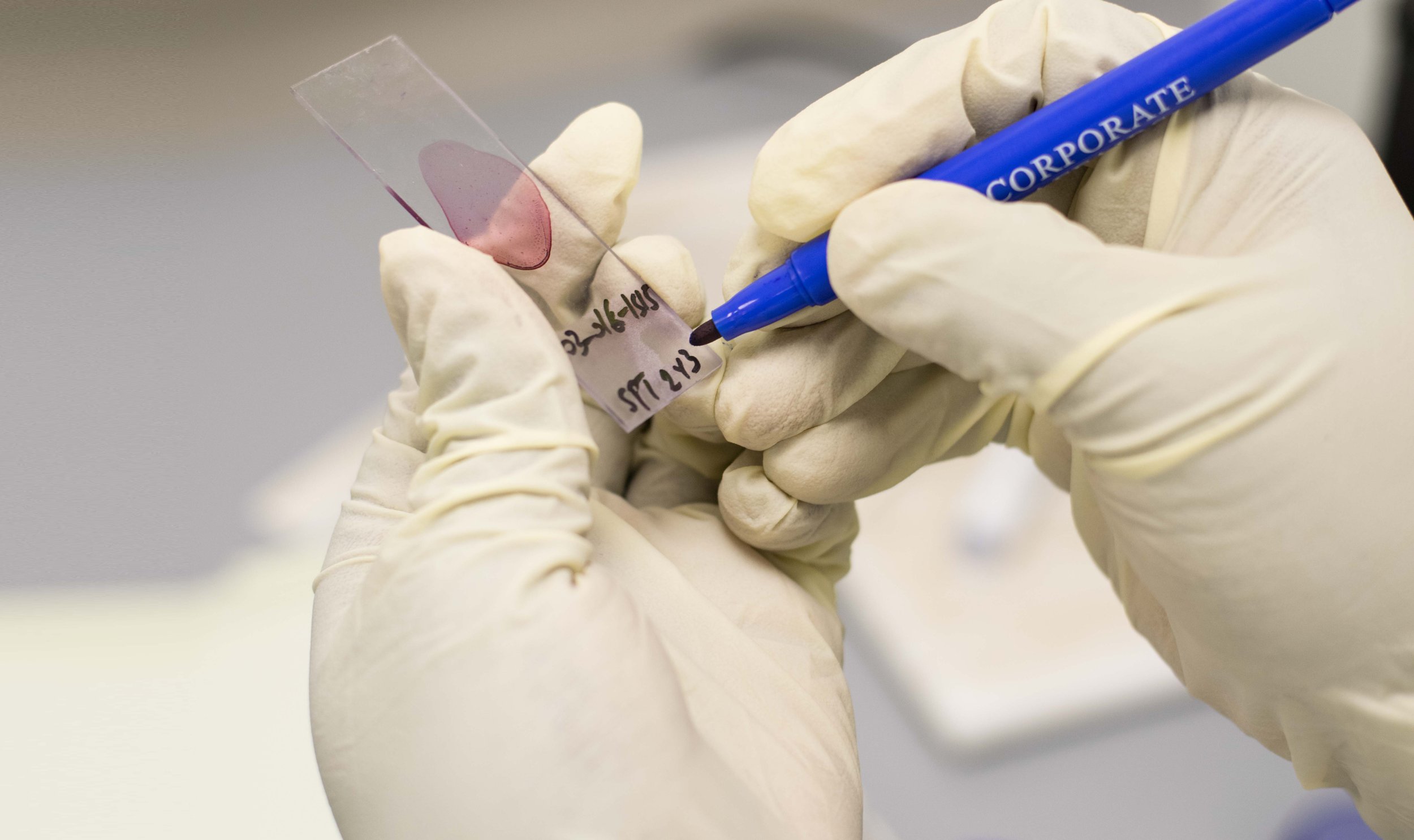How Digital Tools Connect Rural Populations with Modern Diagnostics and Treatment for Tuberculosis (TB)